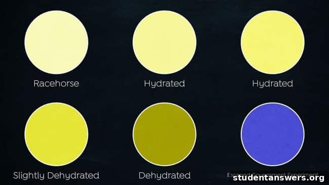Urine color chart showing hydration levels from well-hydrated to severely dehydrated